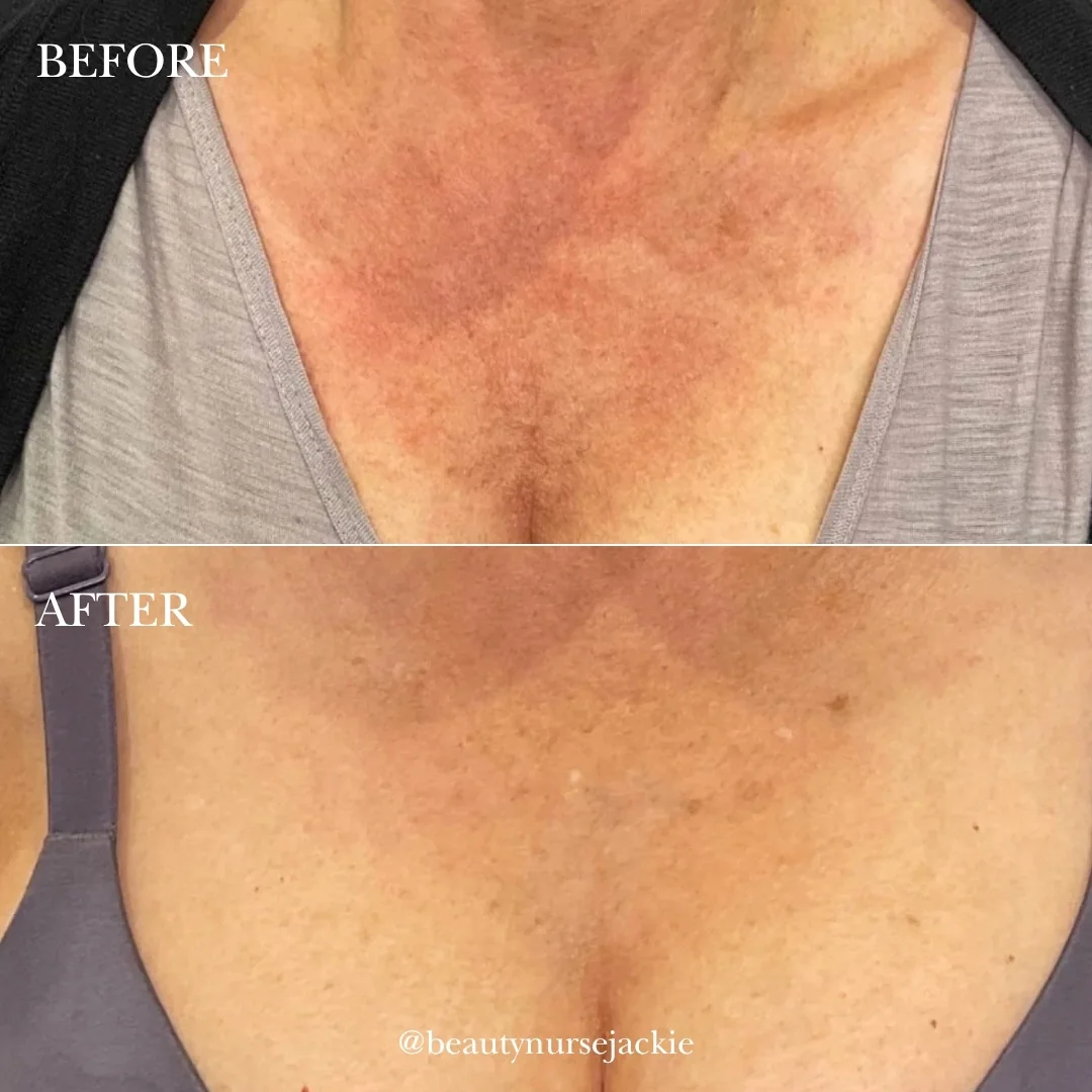 Cleavage chest color and texture repair